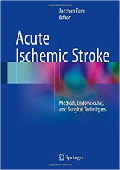 Acute Ischemic Stroke: Medical, Endovascular, and Surgical Techniques