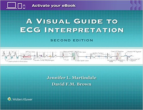 A Visual Guide to ECG Interpretation, 2/e