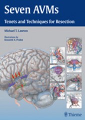 Seven AVMs : Tenets and Techniques for Resection