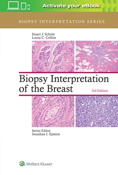 Biopsy Interpretation of the Breast, 3/e