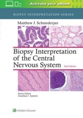 Biopsy Interpretation of the Central Nervous System, 2/e
