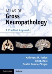 Atlas of Gross Neuropathology: A Practical Approach 