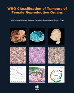 WHO Classification of Tumours of the Female Reproductive Organs, 4/e