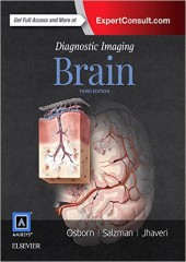 Diagnostic Imaging: Brain, 3/e
